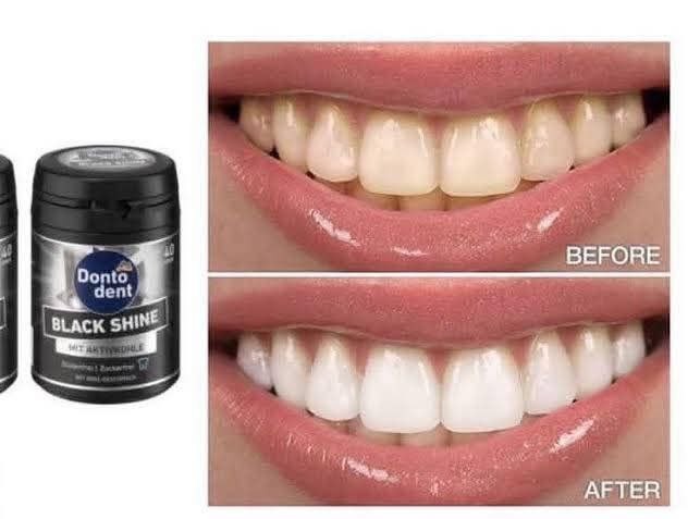 لبان دينتودنت الاسنان